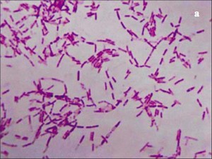 俄科学家给自己注射不死菌 研究长生不老(图)