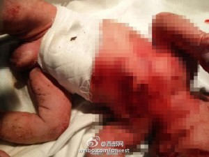 15岁女孩产子后用竹签刺遍男婴全身 致其死亡(图)