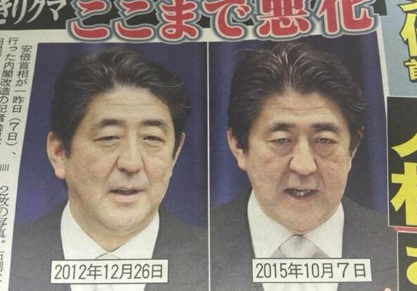 日媒曝光安倍“憔悴照” 猜其已患大肠癌(图)