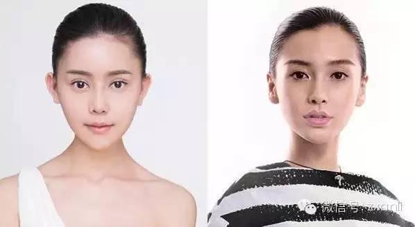 女大学生自爆整形日记 花百万整成Angelababy