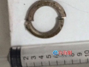 大学生"命根"被铁环卡住 消防员出动成功拆下(图)