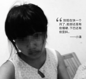 19岁少女被领导要求打美容针 手术失败致毁容(图)