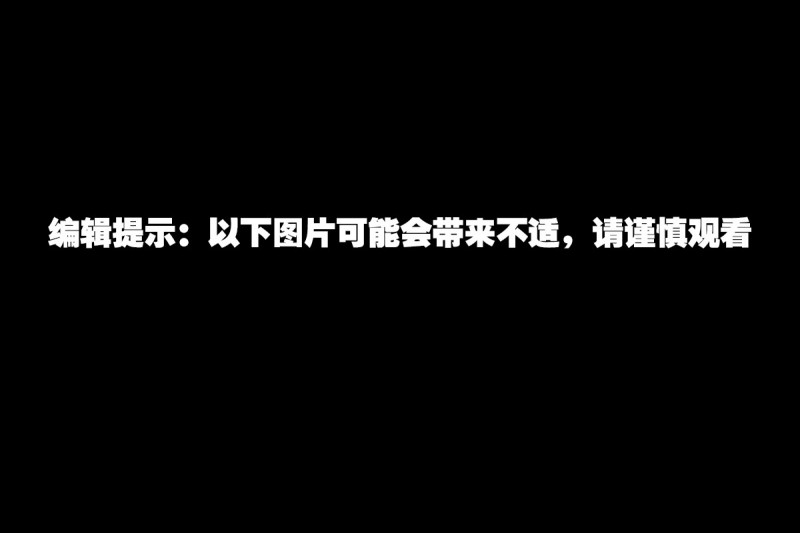 慎入:医托嚣张！南宁女导医制止医托惨遭血腥报复