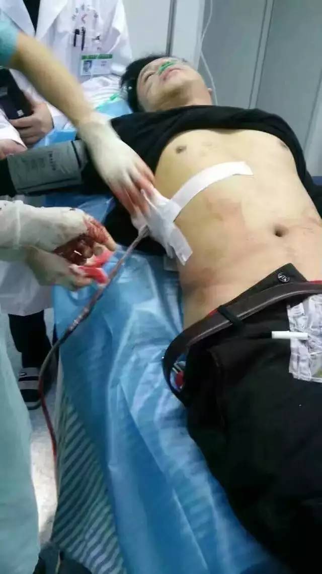 湖南一外科主任被捅胸腹多脏器受损 生命垂危