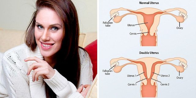 她天生有两套阴道子宫 公布嘿咻真相成网红(图)