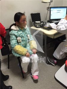 上海：9岁女儿作业没写好 遭母亲打成“熊猫眼”