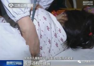 模仿动画片：5岁孩子坠楼，10岁女孩锯掉妹妹鼻子