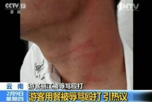 当事人还原“游客丽江就餐被辱骂殴打”真相 (图)