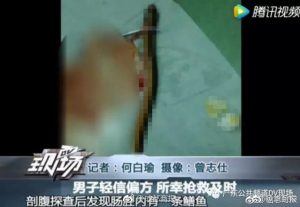 广州男子迷信偏方 将黄鳝塞入肛门"通肠"险丧命